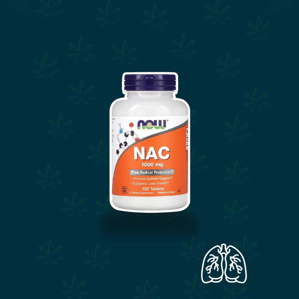 NAC